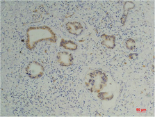 Anti-Cyclophilin B antibody [1B3] used in IHC (Paraffin sections) (IHC-P). GTX34136
