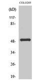 Anti-PPP4R1L antibody used in Western Blot (WB). GTX34138