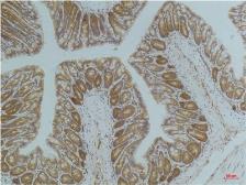 Anti-AMPK alpha 1 antibody [5G11] used in IHC (Paraffin sections) (IHC-P). GTX34141