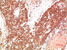 Anti-AMPK alpha 1 antibody [9G3] used in IHC (Paraffin sections) (IHC-P). GTX34142