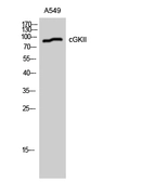 Anti-CGK2 antibody used in Western Blot (WB). GTX34143