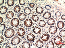 Anti-PTEN antibody [2C10] used in IHC (Paraffin sections) (IHC-P). GTX34150