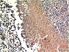 Anti-PTEN antibody [9E8] used in IHC (Paraffin sections) (IHC-P). GTX34151