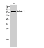 Anti-Calpain 12 antibody used in Western Blot (WB). GTX34157