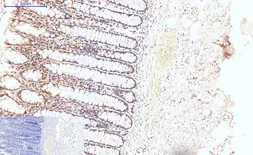 Anti-Caspase 8 antibody [2G12] used in IHC (Paraffin sections) (IHC-P). GTX34167