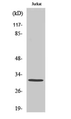 Anti-CBR3 antibody used in Western Blot (WB). GTX34171