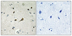 Anti-RPL39 antibody used in IHC (Paraffin sections) (IHC-P). GTX34176