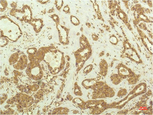 Anti-p70 S6K antibody [1C7] used in IHC (Paraffin sections) (IHC-P). GTX34178