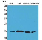 Anti-Eotaxin 3 antibody used in Western Blot (WB). GTX34186