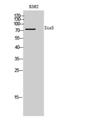 Anti-SIX5 antibody used in Western Blot (WB). GTX34199