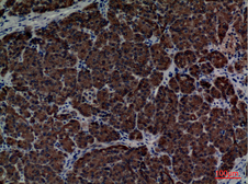 Anti-CD1E antibody used in IHC (Paraffin sections) (IHC-P). GTX34207