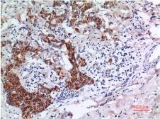 Anti-SMAD3 antibody [1E8] used in IHC (Paraffin sections) (IHC-P). GTX34209