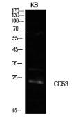 Anti-CD53 antibody used in Western Blot (WB). GTX34220