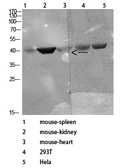 Anti-CD72 antibody used in Western Blot (WB). GTX34221