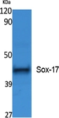 Anti-SOX17 antibody used in Western Blot (WB). GTX34224