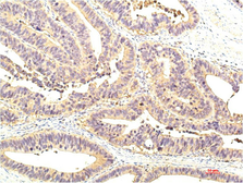 Anti-STAT1 antibody [8H11] used in IHC (Paraffin sections) (IHC-P). GTX34231
