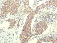 Anti-STAT1 antibody [12E8] used in IHC (Paraffin sections) (IHC-P). GTX34232