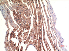 Anti-VE-Cadherin antibody [8E5] used in IHC (Paraffin sections) (IHC-P). GTX34239