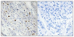 Anti-TBP antibody used in IHC (Paraffin sections) (IHC-P). GTX34251