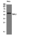 Anti-TBPL2 antibody used in Western Blot (WB). GTX34255