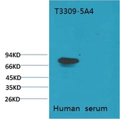 Anti-Transferrin antibody [5A4] used in Western Blot (WB). GTX34262