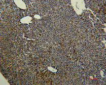 Anti-Transferrin antibody [3A5] used in IHC (Paraffin sections) (IHC-P). GTX34264