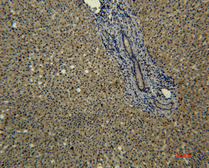 Anti-Transferrin antibody [6D6] used in IHC (Paraffin sections) (IHC-P). GTX34269