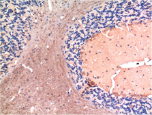 Anti-TGF beta 1 antibody [5D2] used in IHC (Paraffin sections) (IHC-P). GTX34272