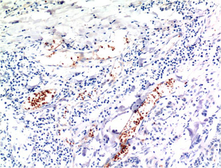 Anti-TGF beta 1 antibody [10E5] used in IHC (Paraffin sections) (IHC-P). GTX34273