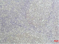 Anti-TNF alpha antibody [Q34] used in IHC (Paraffin sections) (IHC-P). GTX34274