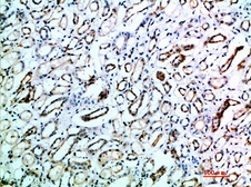 Anti-TSPAN7 antibody used in IHC (Paraffin sections) (IHC-P). GTX34283