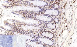 Anti-beta Tubulin I antibody [5G3] (HRP) used in IHC (Paraffin sections) (IHC-P). GTX34285