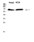 Anti-ZFP91 antibody used in Western Blot (WB). GTX34303