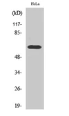 Anti-ZNF18 antibody used in Western Blot (WB). GTX34305
