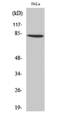 Anti-ZNF225 antibody used in Western Blot (WB). GTX34307