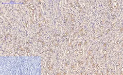 Anti-CD21 antibody [2C5] used in IHC (Paraffin sections) (IHC-P). GTX34330