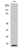 Anti-CST11 antibody used in Western Blot (WB). GTX34333