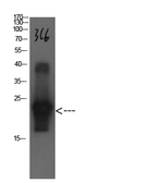 Anti-Cystatin C antibody [3C6] used in Western Blot (WB). GTX34335