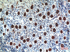 Anti-Cystatin C antibody [5F1] used in IHC (Paraffin sections) (IHC-P). GTX34337