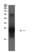 Anti-Cystatin C antibody [3B12] used in Western Blot (WB). GTX34338