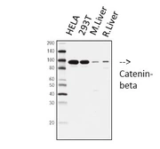 Anti-beta Catenin antibody [4F2] used in Western Blot (WB). GTX34339