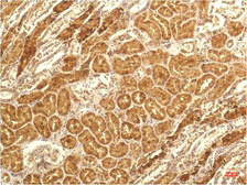 Anti-CXCL8 / IL8 antibody [14E1] used in IHC (Paraffin sections) (IHC-P). GTX34340