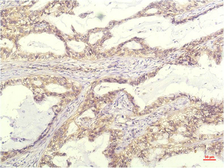 Anti-CXCL8 / IL8 antibody [13F8] used in IHC (Paraffin sections) (IHC-P). GTX34341