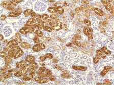 Anti-CXCL8 / IL8 antibody [8B1] used in IHC (Paraffin sections) (IHC-P). GTX34342