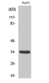 Anti-DHRS4 antibody used in Western Blot (WB). GTX34353