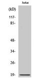 Anti-RCL antibody used in Western Blot (WB). GTX34356