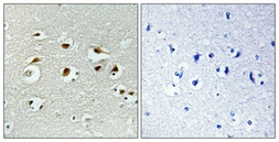 Anti-EID1 antibody used in IHC (Paraffin sections) (IHC-P). GTX34362