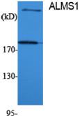 Anti-ALMS1 antibody used in Western Blot (WB). GTX34374