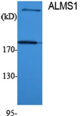 Anti-ALMS1 antibody used in Western Blot (WB). GTX34374