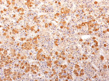 Anti-ACTH antibody [57] used in IHC (Paraffin sections) (IHC-P). GTX34388